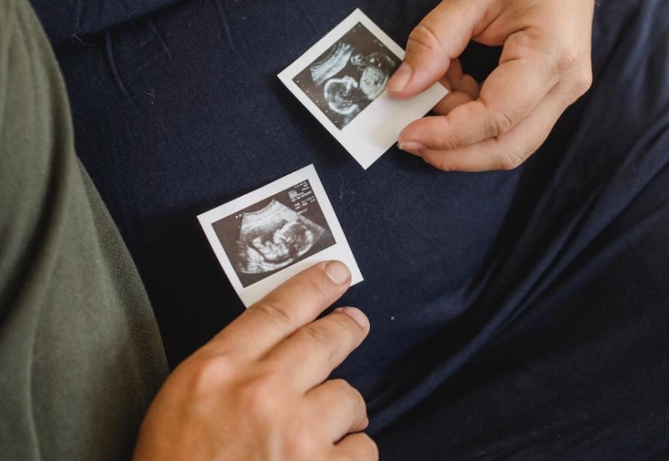 Ramón Acosta: «Un corazón lleno de amor, siempre estará a favor de la vida»